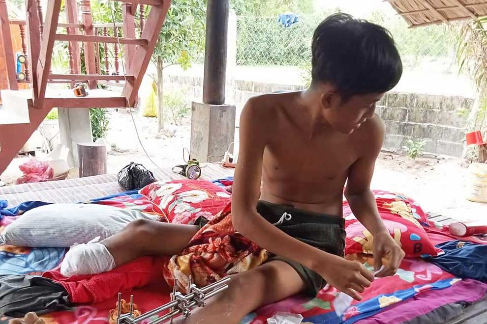 The accident left Samnang, 15, with life-changing injuries. SUPPLIED