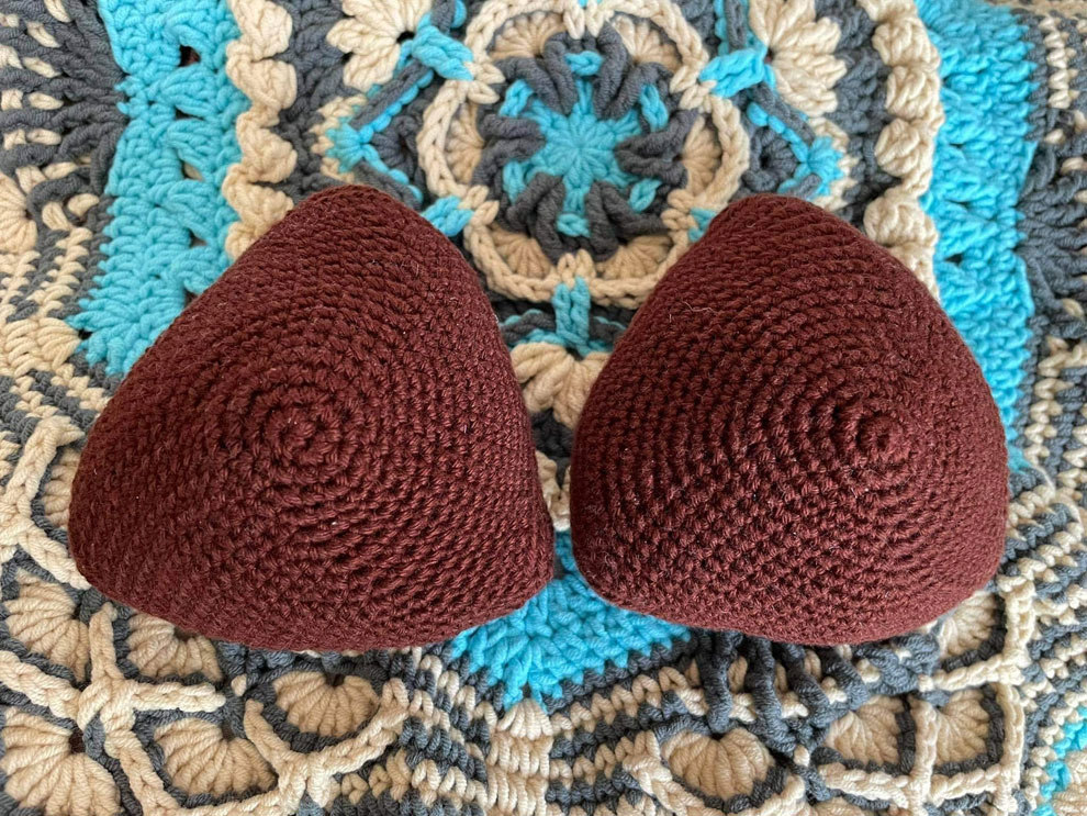 External Breast Prosthetic produced Cambodia Knitted Knockers. SUPPLIED