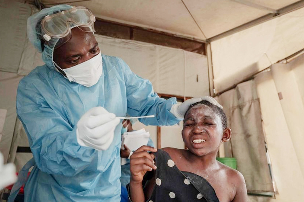 A patient is tested for mpox in the Democratic Republic of the Congo (DRC), the epicentre of an epidemic that was declared a global health emergency, on August 17. AFP