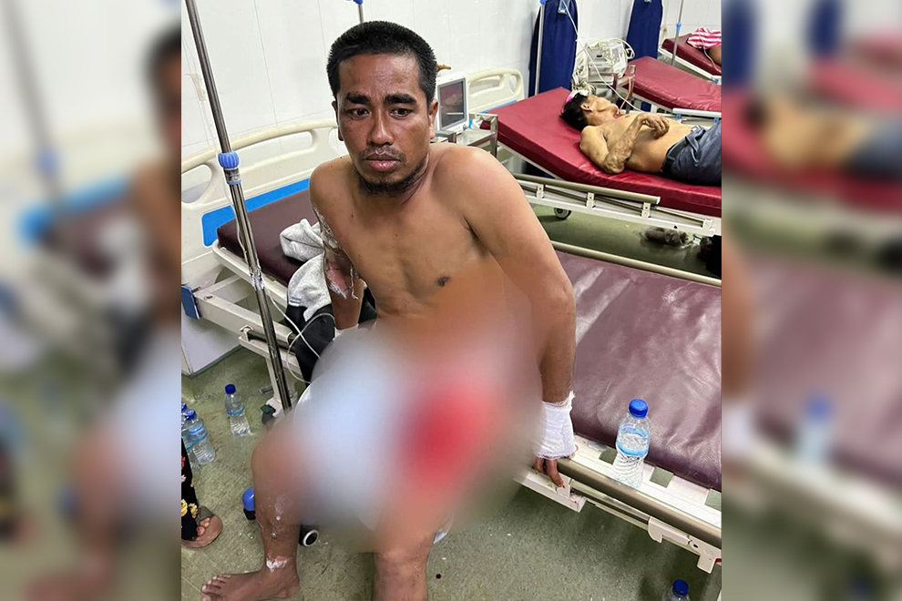 Injured individual from the flame. National police