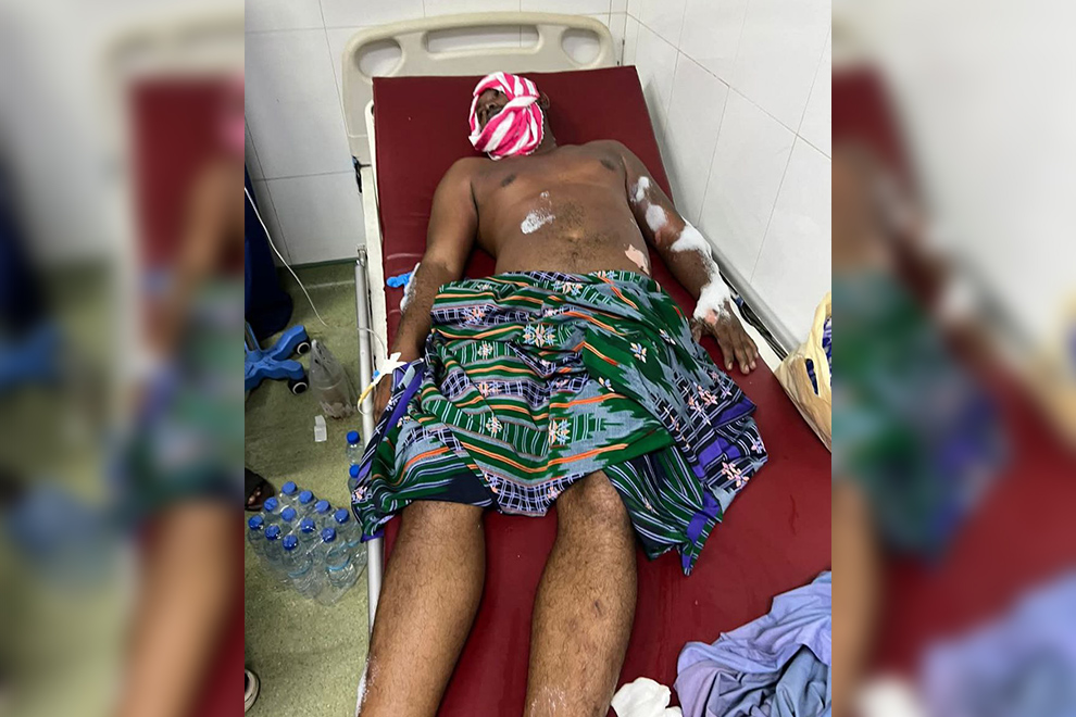 Injured individual from the flame. National police