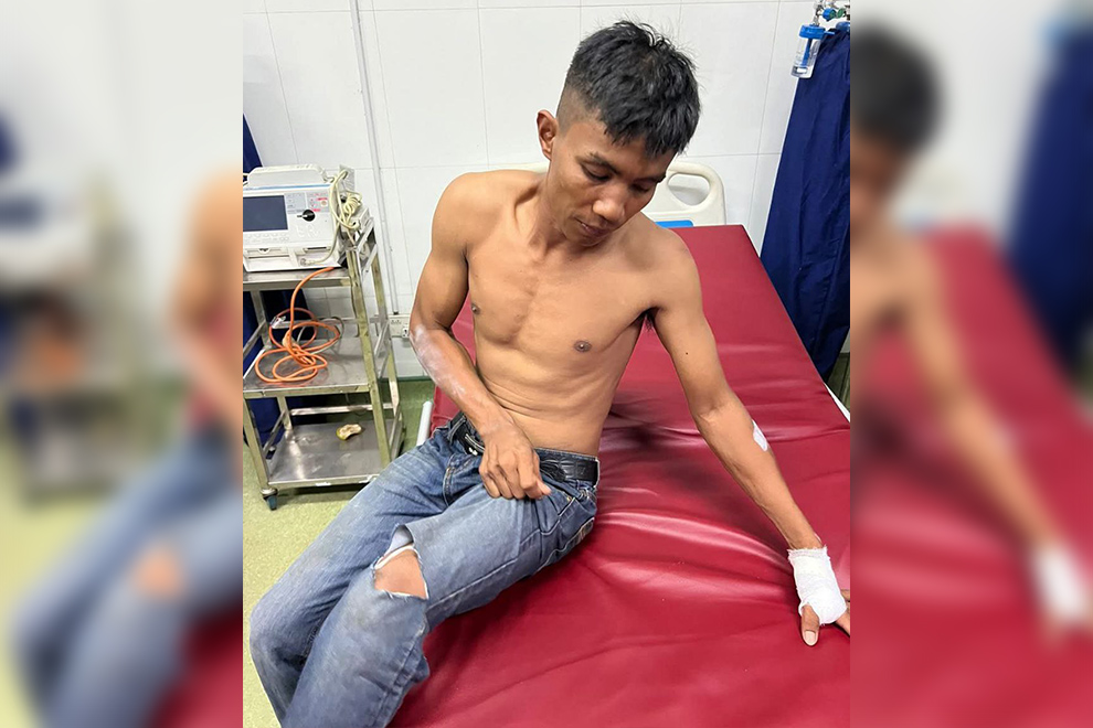 Injured individual from the flame. National police