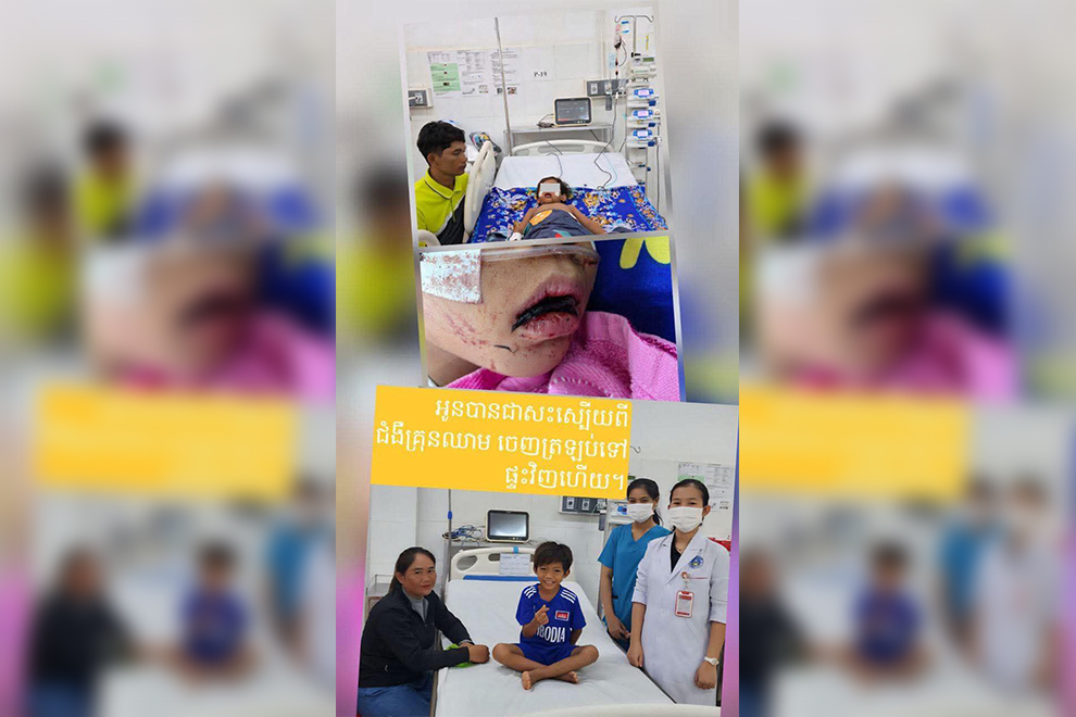 An eight-year-old with a severe case of dengue fever has made a full recovery, thanks to the care provided at the Jayavarman VII Hospital in Siem Reap. Beat Richner foundation