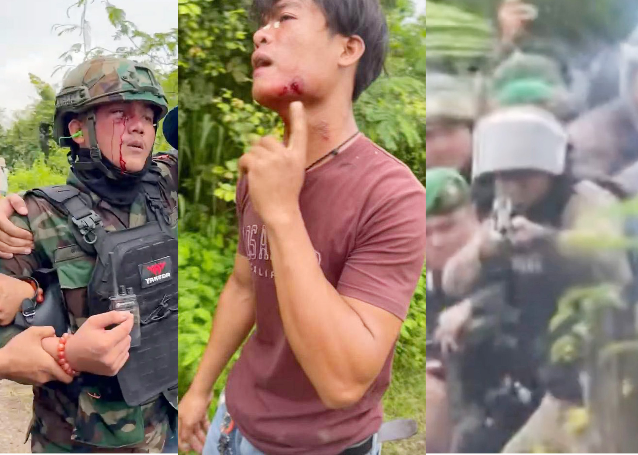 Numerous Cambodians were injured in the attack, including monks and members of the armed forces. Supplied