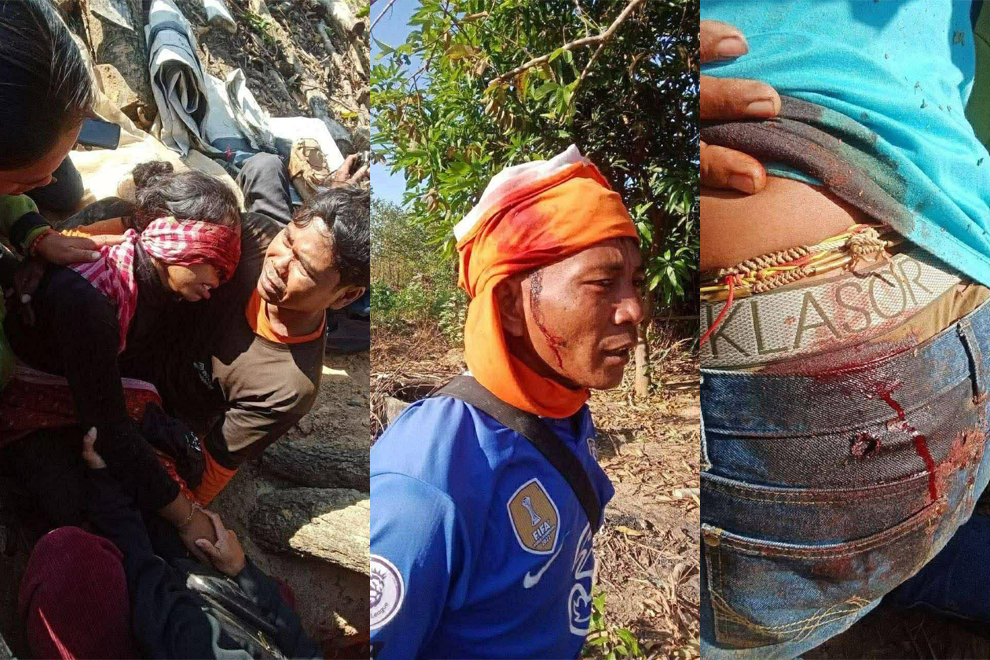 Numerous Cambodian civilians have been killed and wounded by Thai shelling and airstrikes. Supplied