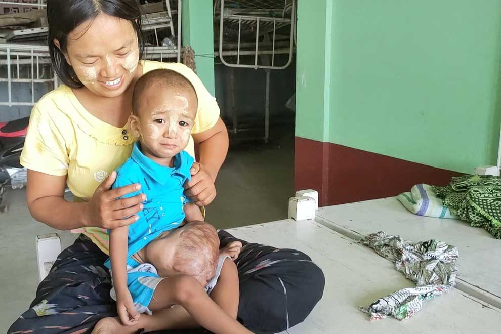 Japan Heart treats Myanmar toddler
