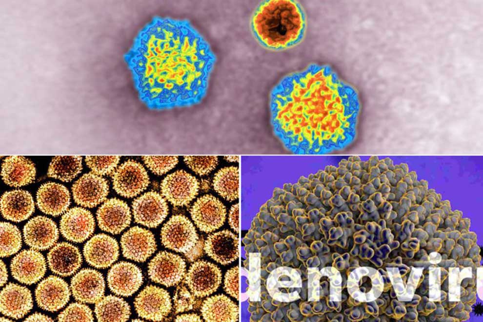 Child hepatitis found in 20 countries