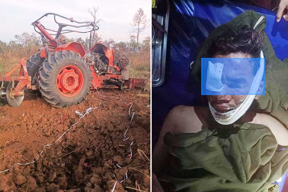 CMAA: Mine victims down 65 per cent